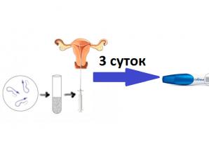 Как вести себя до и после подсадки эмбрионов, чтобы эко закончилось беременностью
